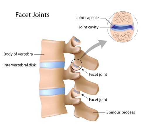 facet-joint-injection